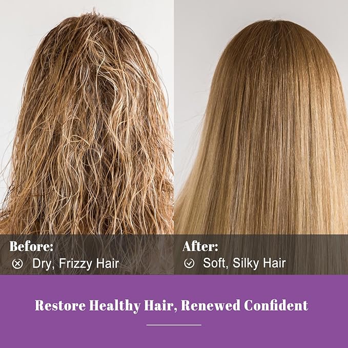 Aceite Esencial de Romero 100% Puro